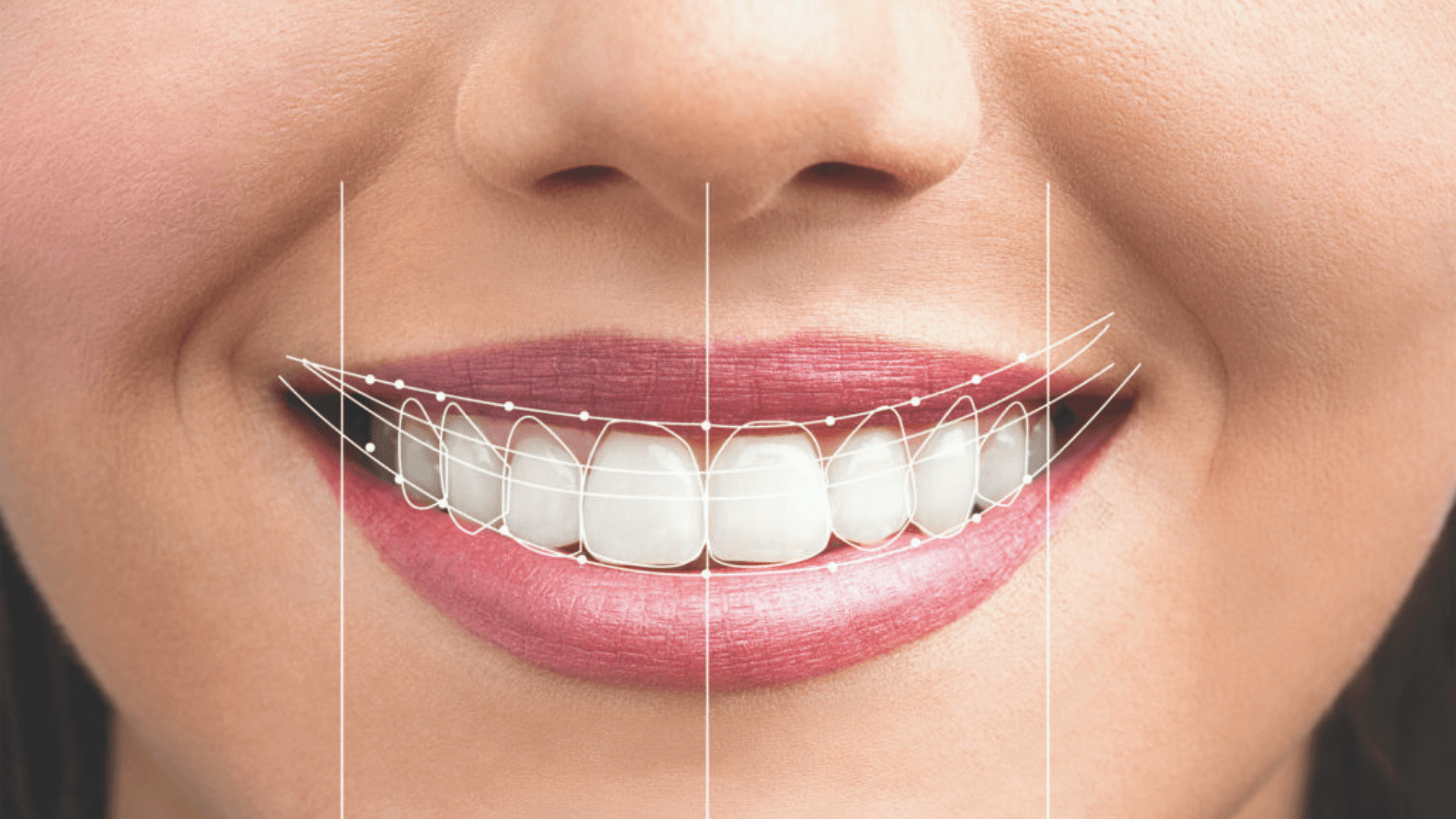 Stop Hiding Your Mouth: How to Have a Beautiful Smile at Any Age
